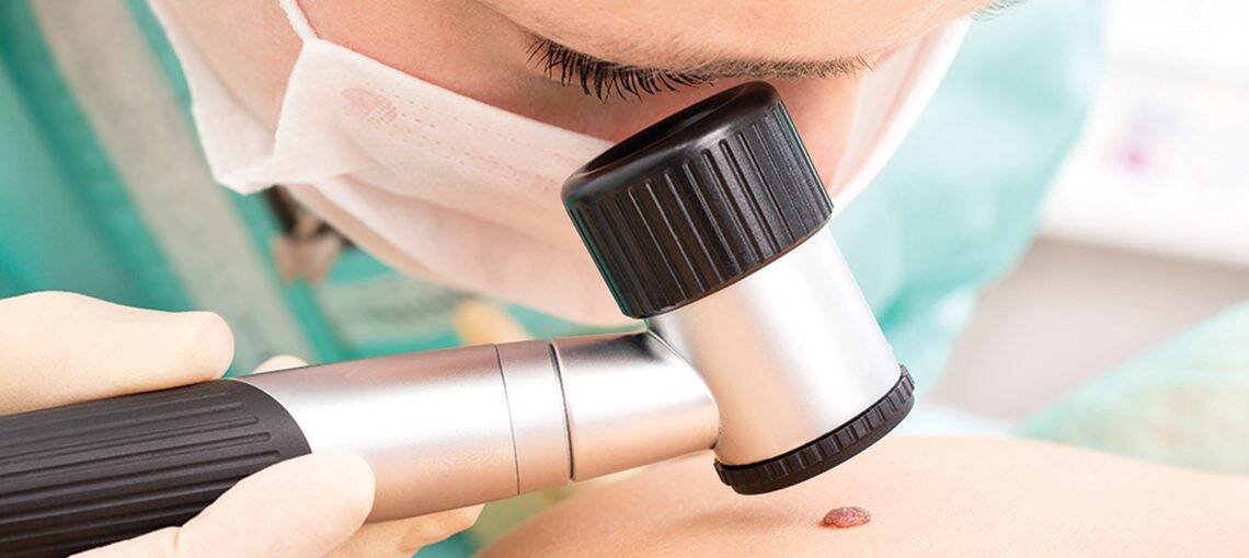 4Ways MelanomaImmunotherapy