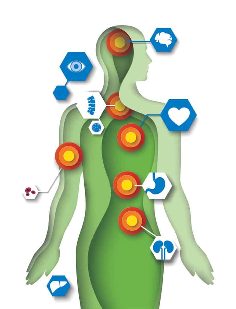 BodyScan