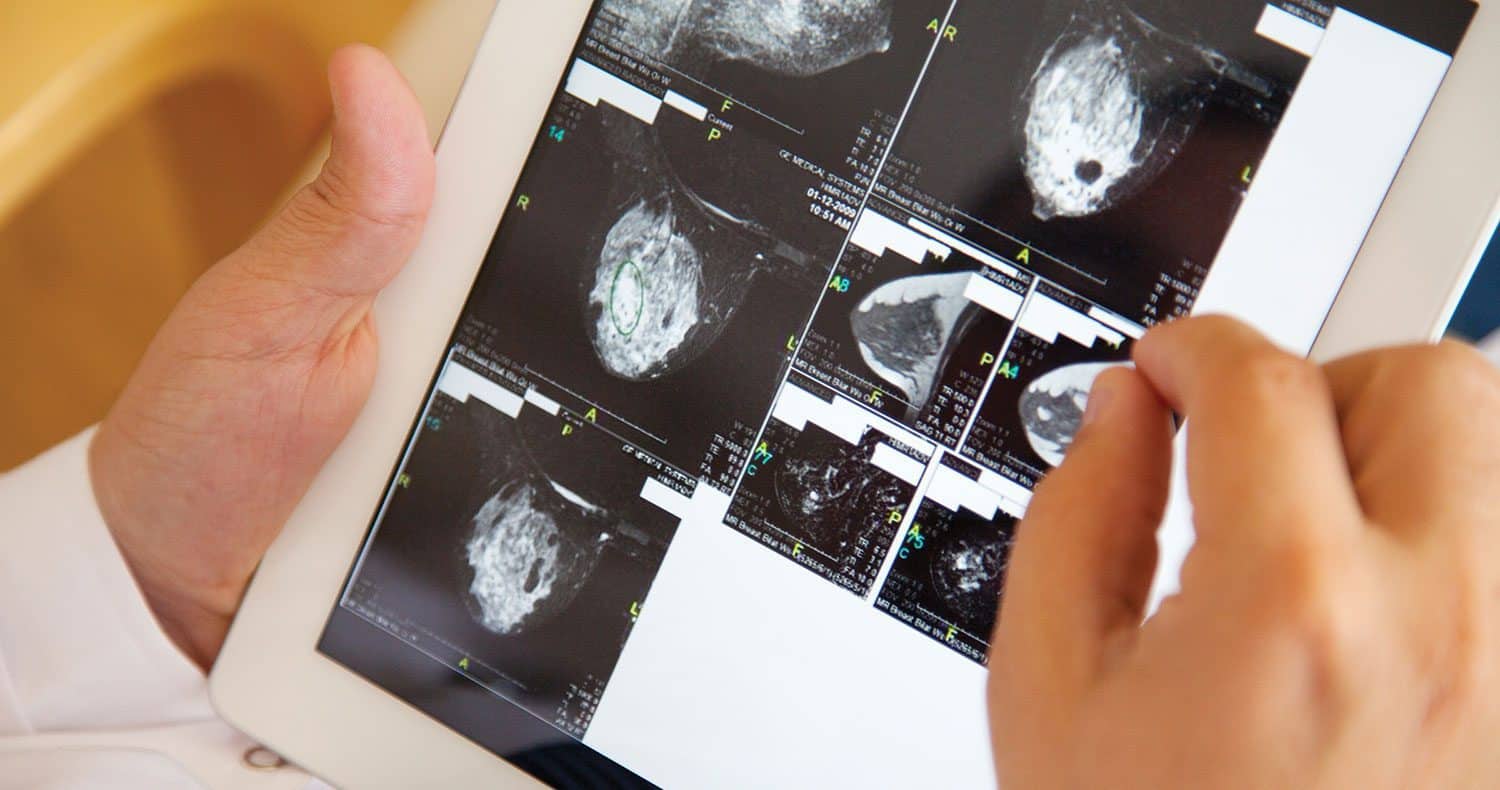 LeapSummer2020 5Ways BreastXRay