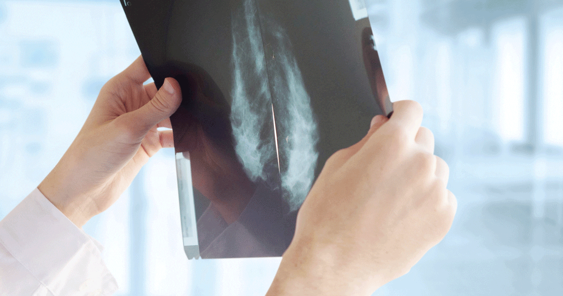LungScreening 4Ways Fall2018