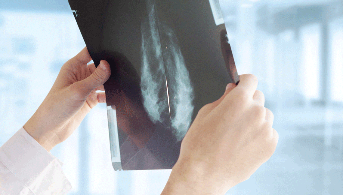 Web Leap Sp18 5Ways Xray Shutterstock